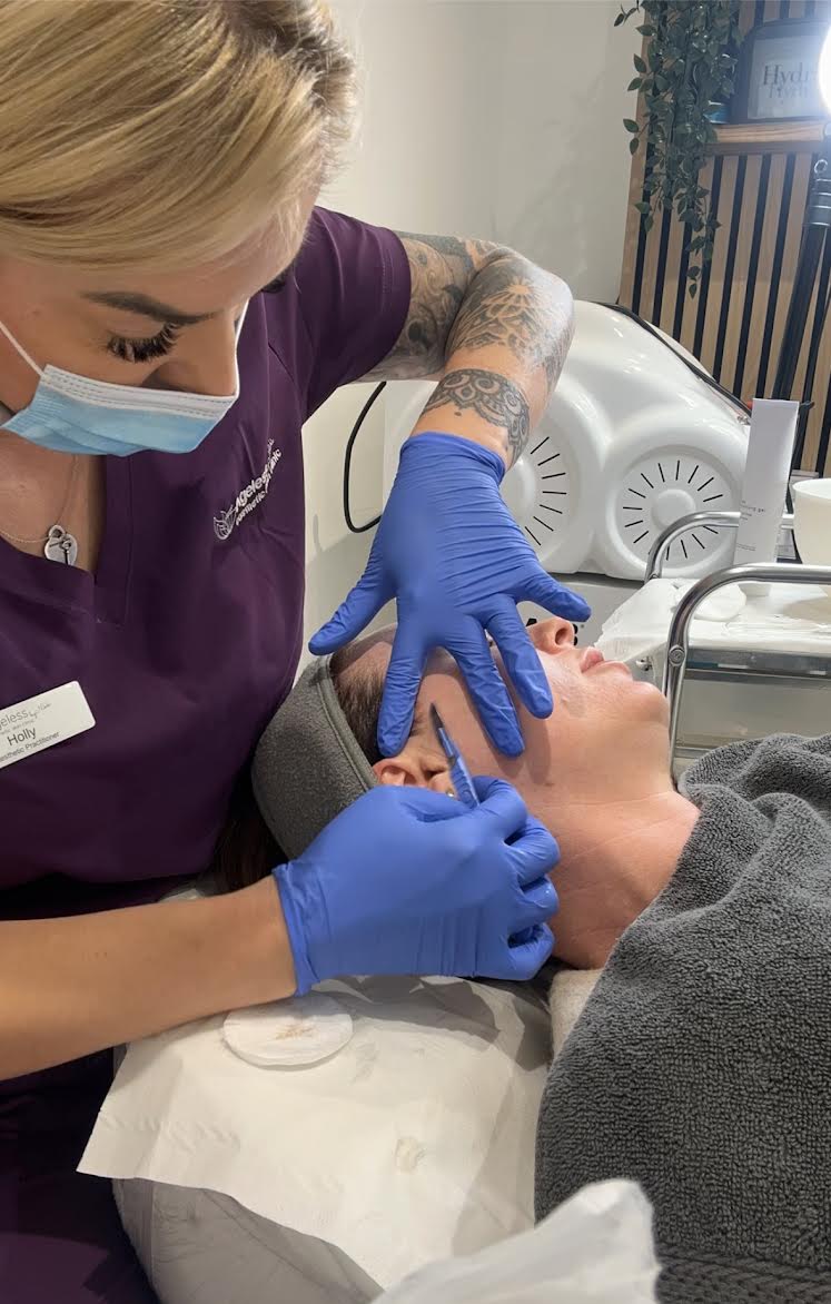 Lactic Chemical Peel