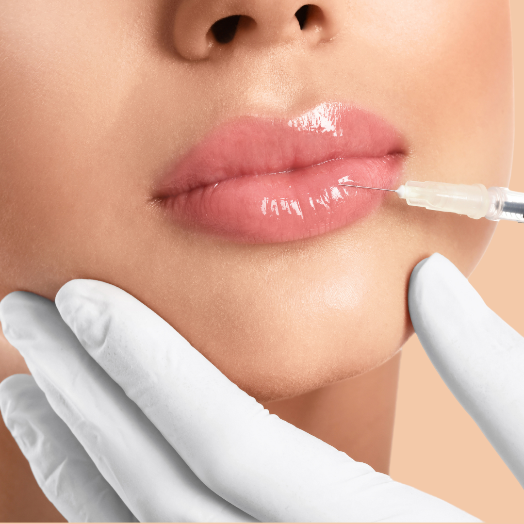 Dermal Fillers - Lips and fine lines 1ml