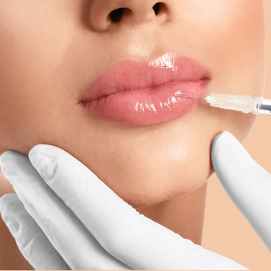 Dermal Fillers - Lips and fine lines 1ml
