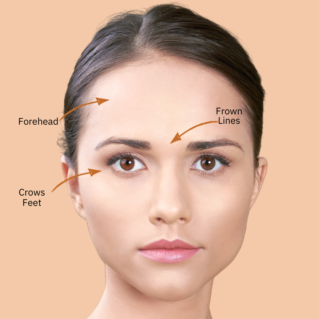 Anti-wrinkle treatment  - two areas
