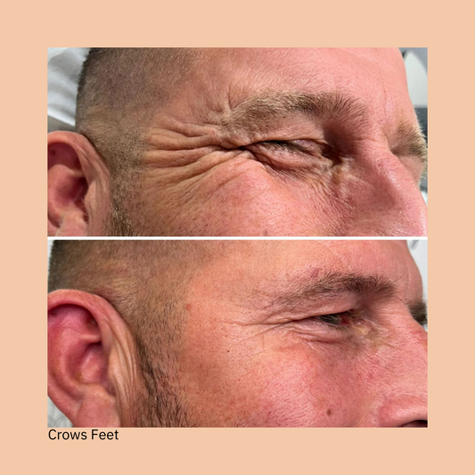 SMOOTH MEMBERSHIP PLAN- 6 months