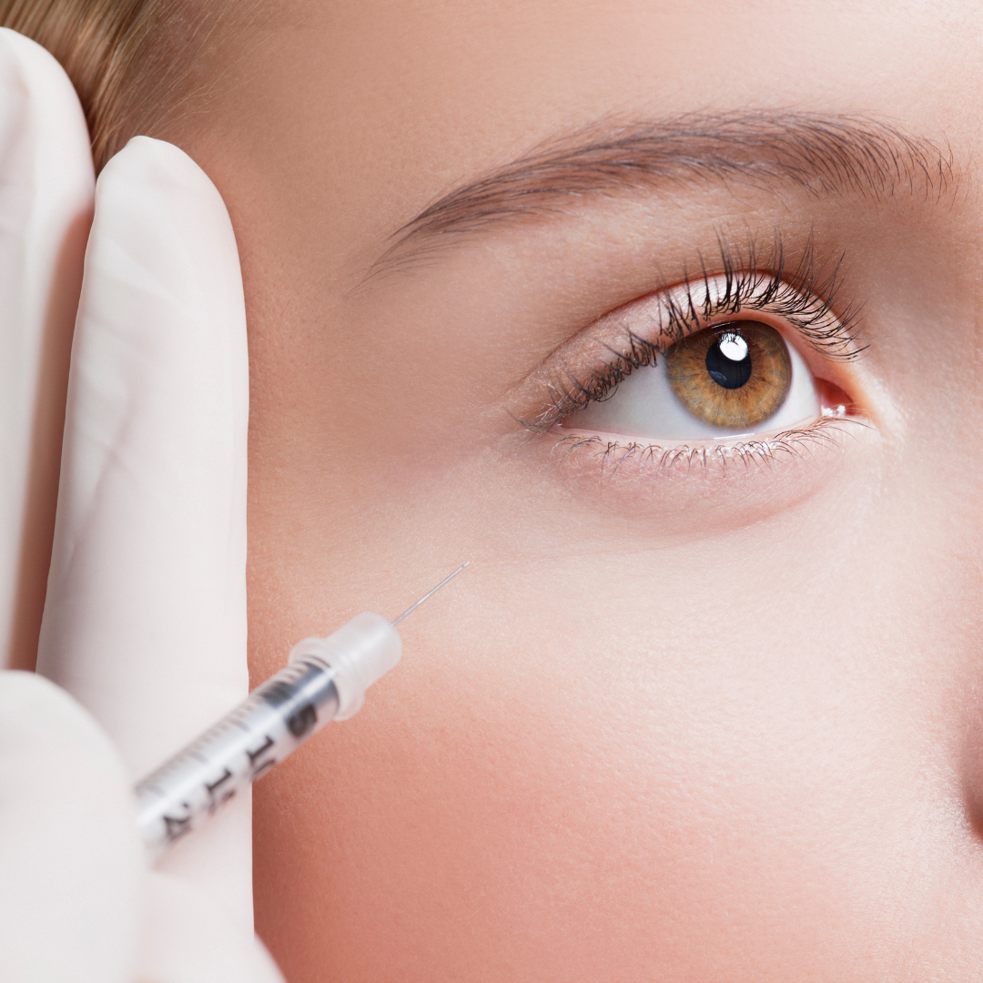 Dermal Fillers - Tear Trough