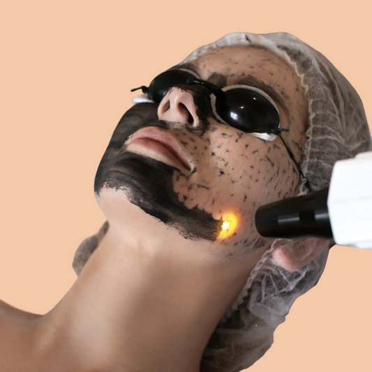 Carbon Laser Facial  - 3 Sessions