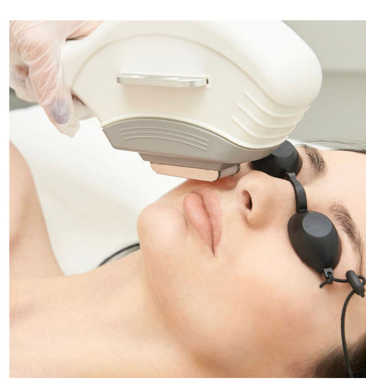 IPL Laser Hair Removal - Full Face 6 Sessions