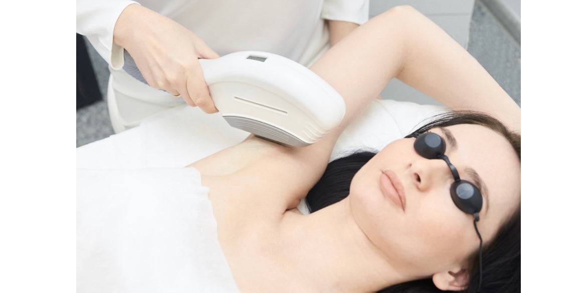 IPL Laser Hair Removal - Under Arms 10 Sessions