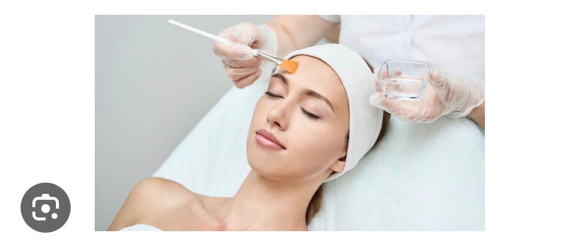 Lactic Chemical Peel
