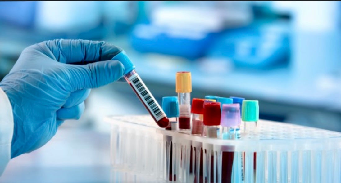 Nutritional Deficiencies Blood Test
