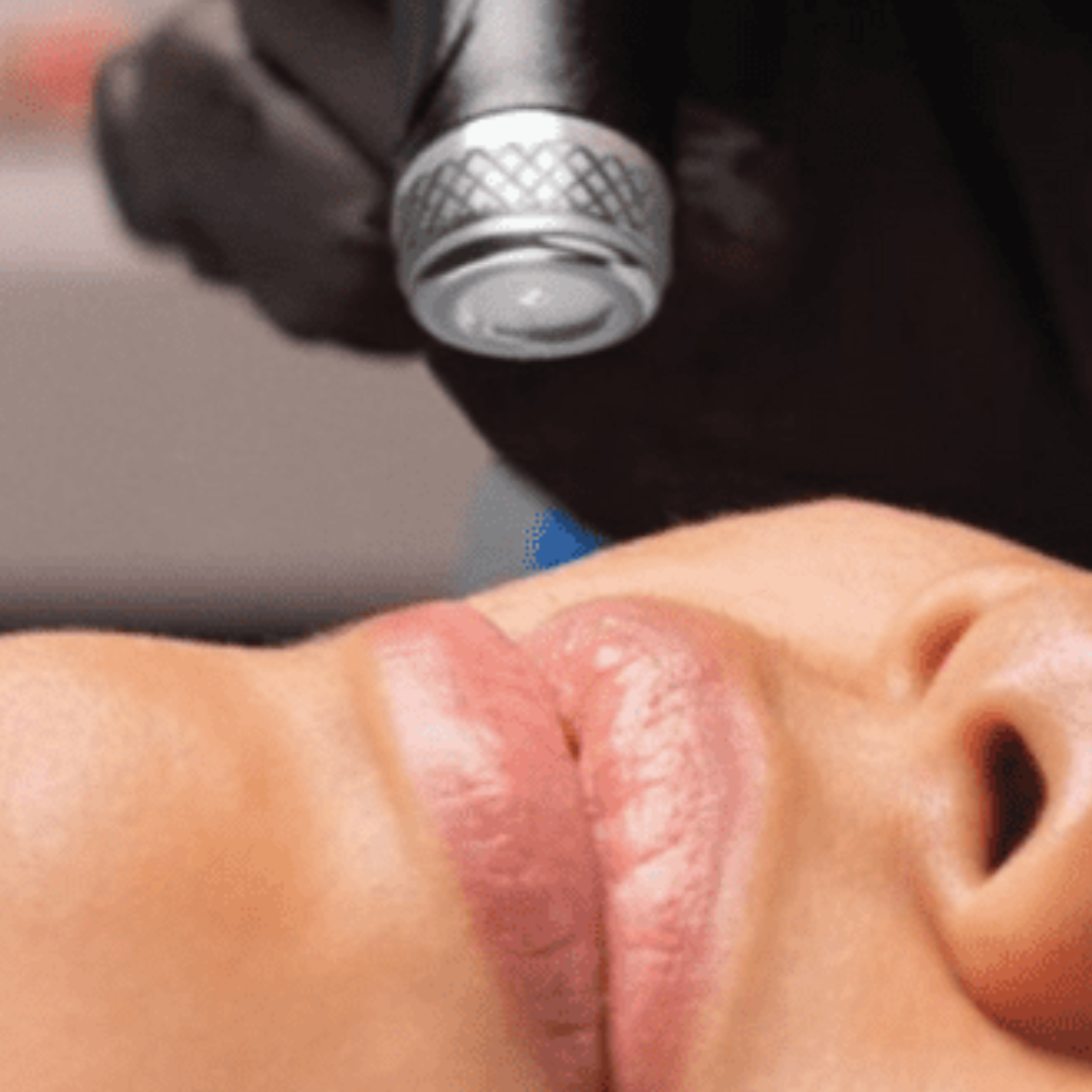 THE SKIN CLUB MEMBERSHIP- 6 months