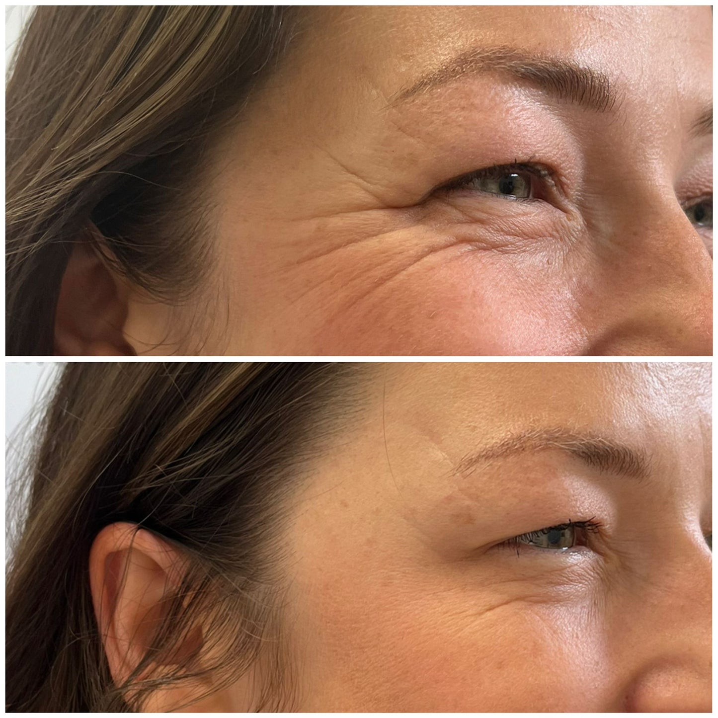 SMOOTH MEMBERSHIP PLAN- 6 months