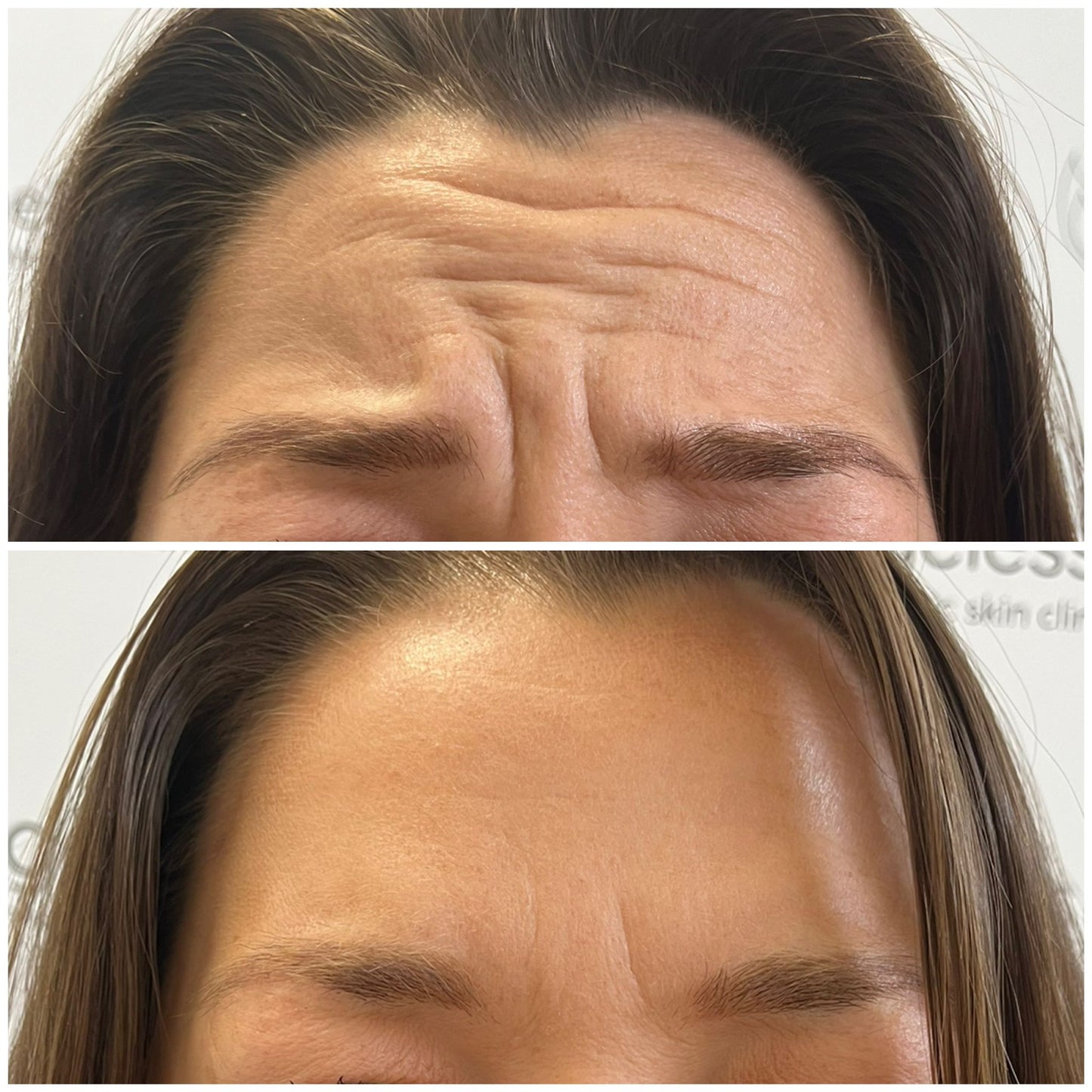 SMOOTH MEMBERSHIP PLAN- 6 months