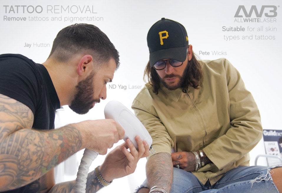 Laser Tattoo Removal - Consultation and treatment