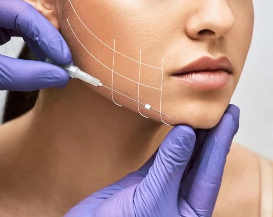 Full face and Neck PDO Thread Lift