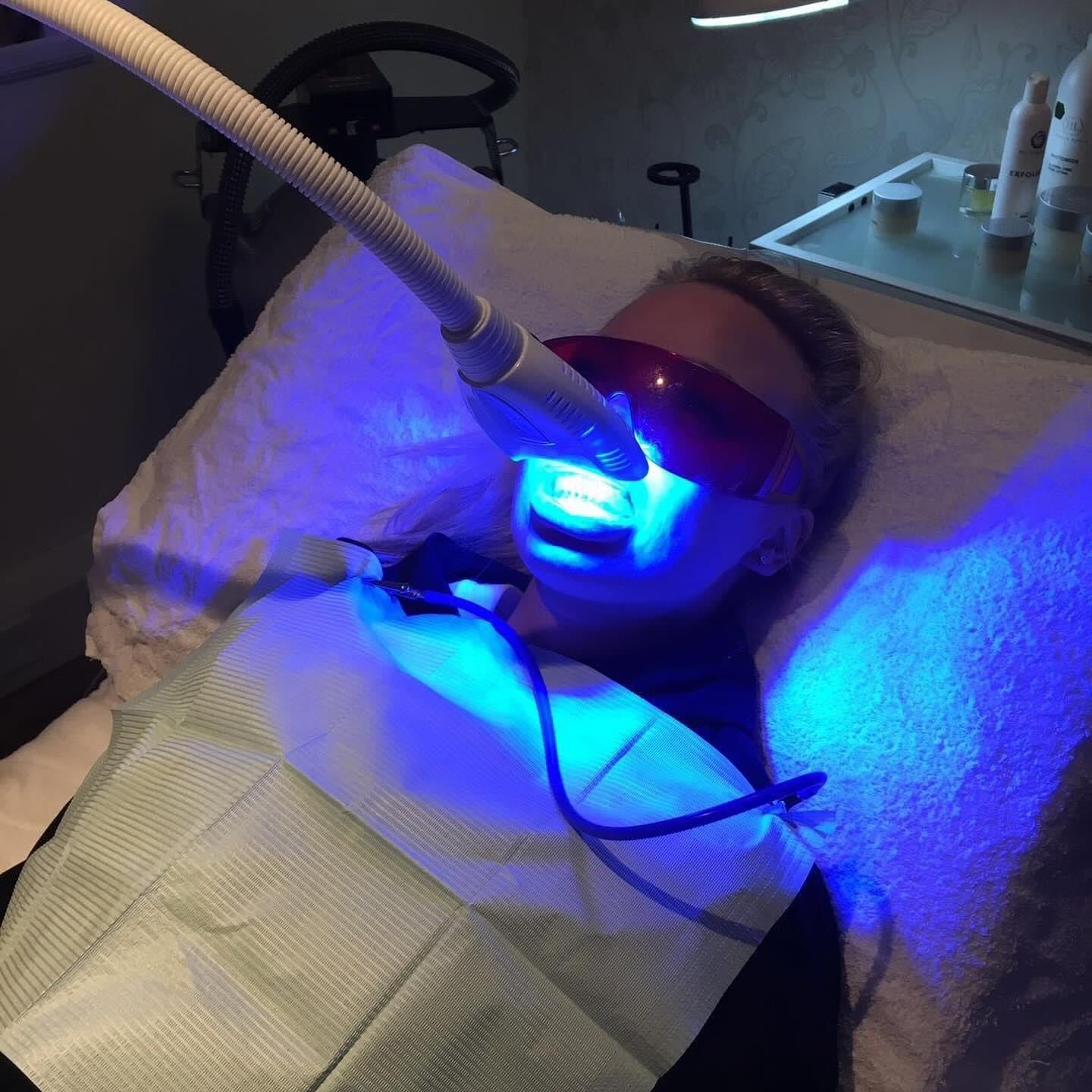 Teeth Whitening