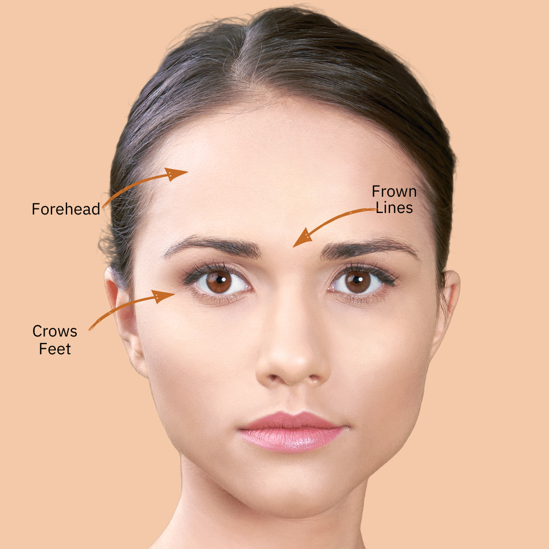 Anti-wrinkle treatment  - three areas