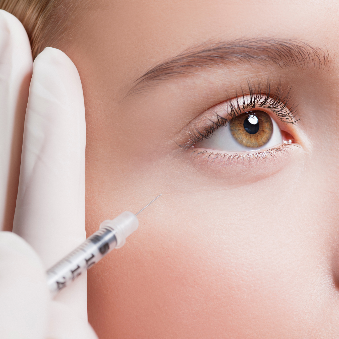 Dermal Fillers - Tear Trough – Ageless By Nikki