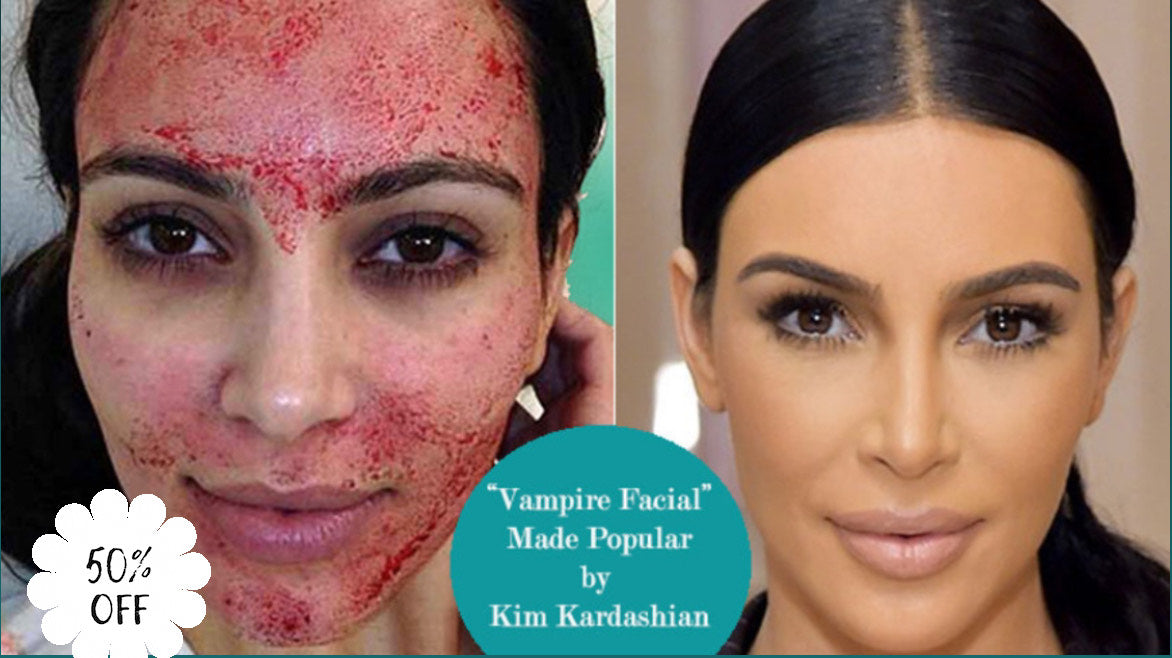 Vampire PRP Facial